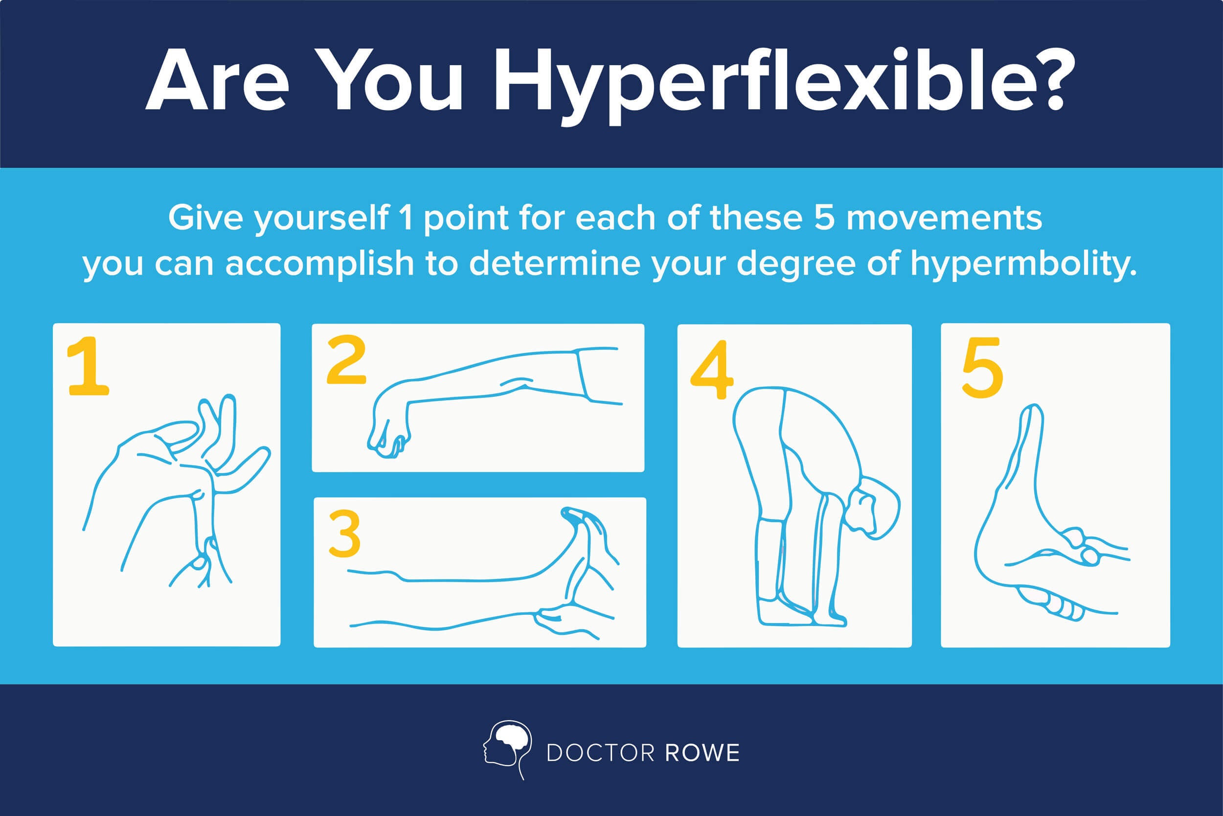 Hypermobility breighton score Justliveblog nl Hypermobility breighton score Justliveblog nl